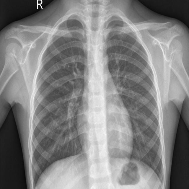 example1.jpg